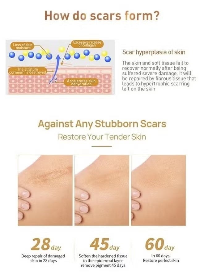 لان بينا جل للعناية بالبشرة ، كريم إصلاح الندبات العشبية 30 جم ، جل ندبات ، جل إصلاح البشرة ، مكونات نباتية طبيعية ، إصلاح الندبات القديمة والجديدة بشكل فعال ، الحروق ، علامات التمدد ، حب الشباب ، حروق الشمس ، 30 جرام - Image 3